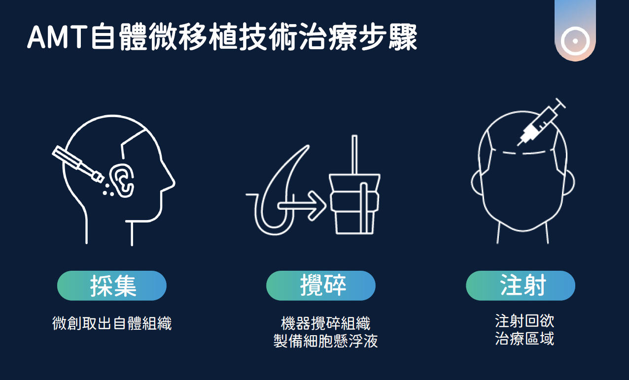 RA-自體微移植育髮